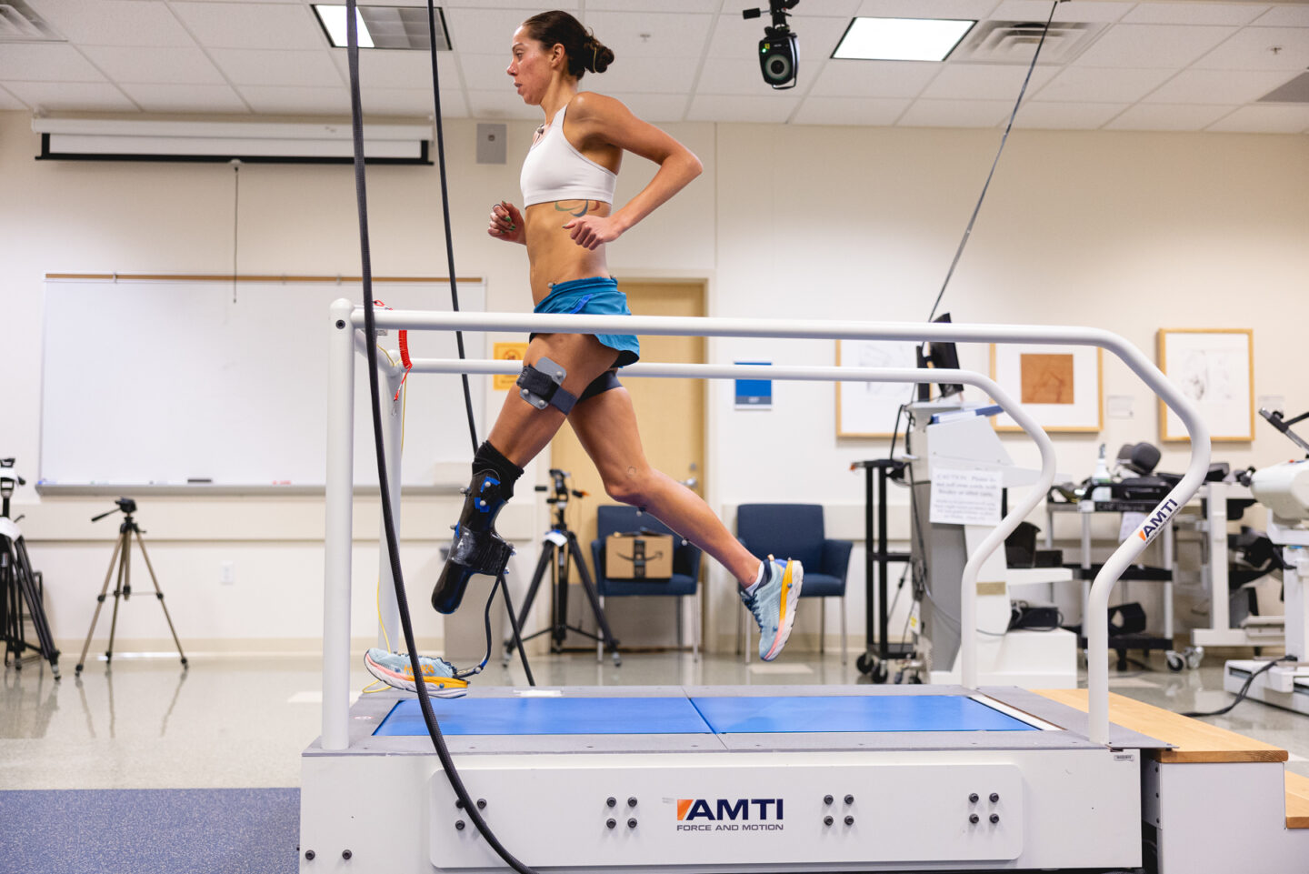 Runner with prosthetic leg undergoing gait analysis on treadmill.