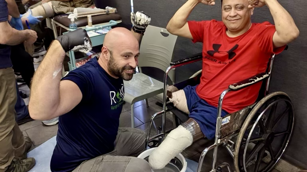 prosthetist building a prosthetic leg for a patient in Guatemala